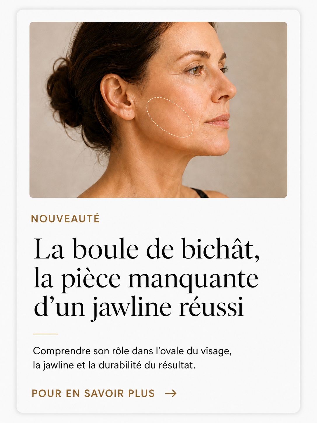 article boulde de bichat