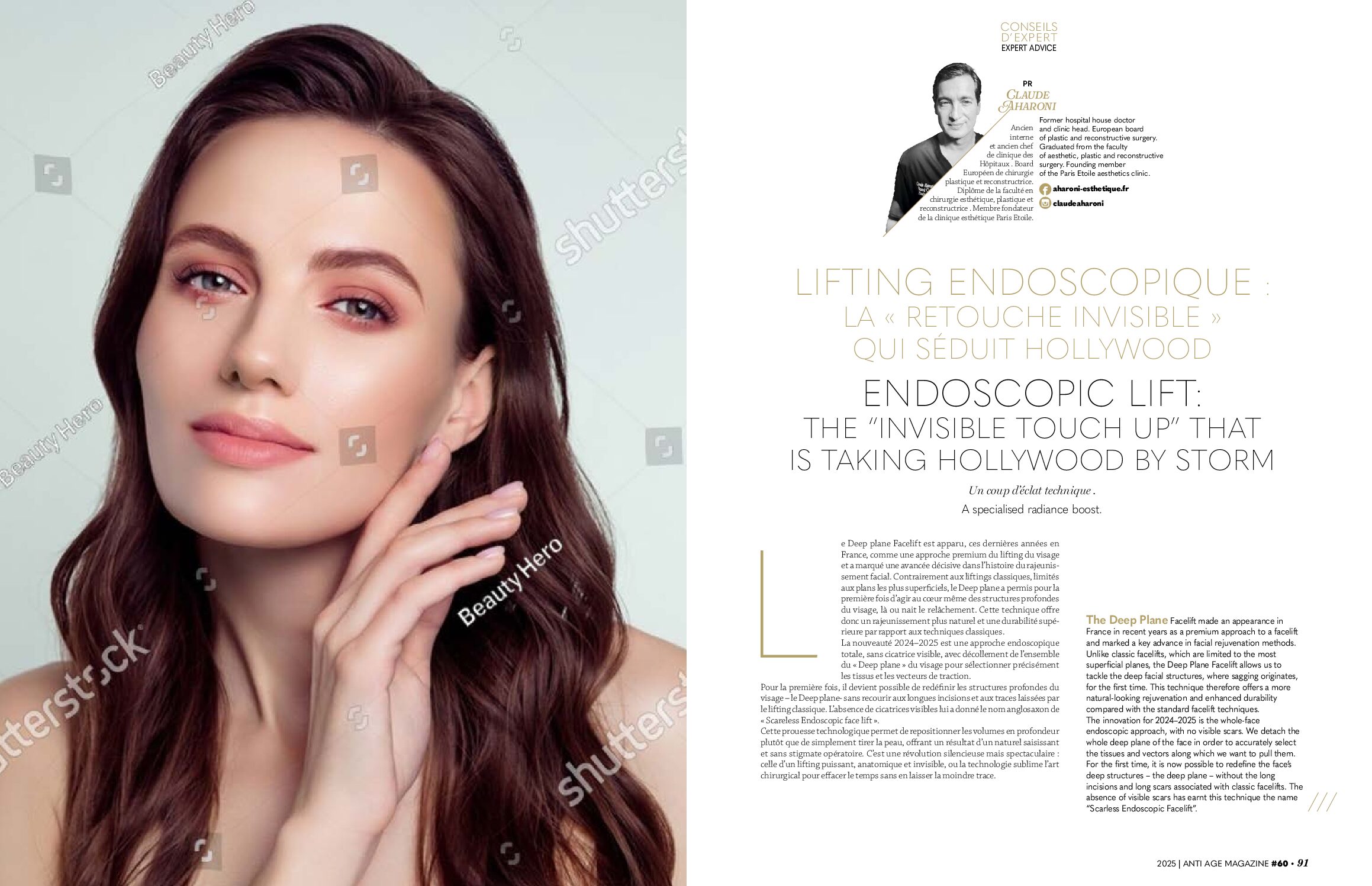 article lifting endoscopic 4 pdf