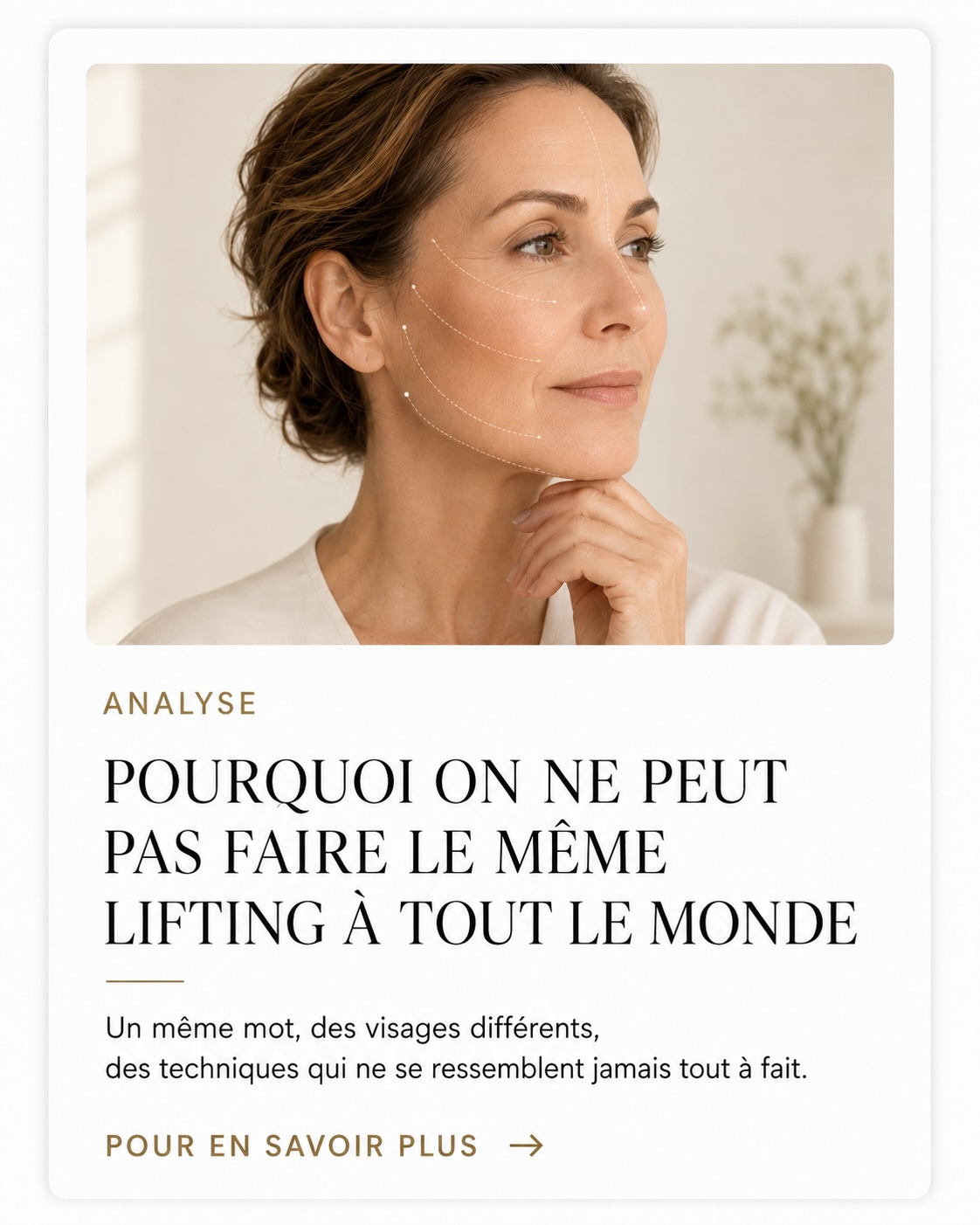 carte pourquoi on ne peut pas faire le meme lifting a tous le monde